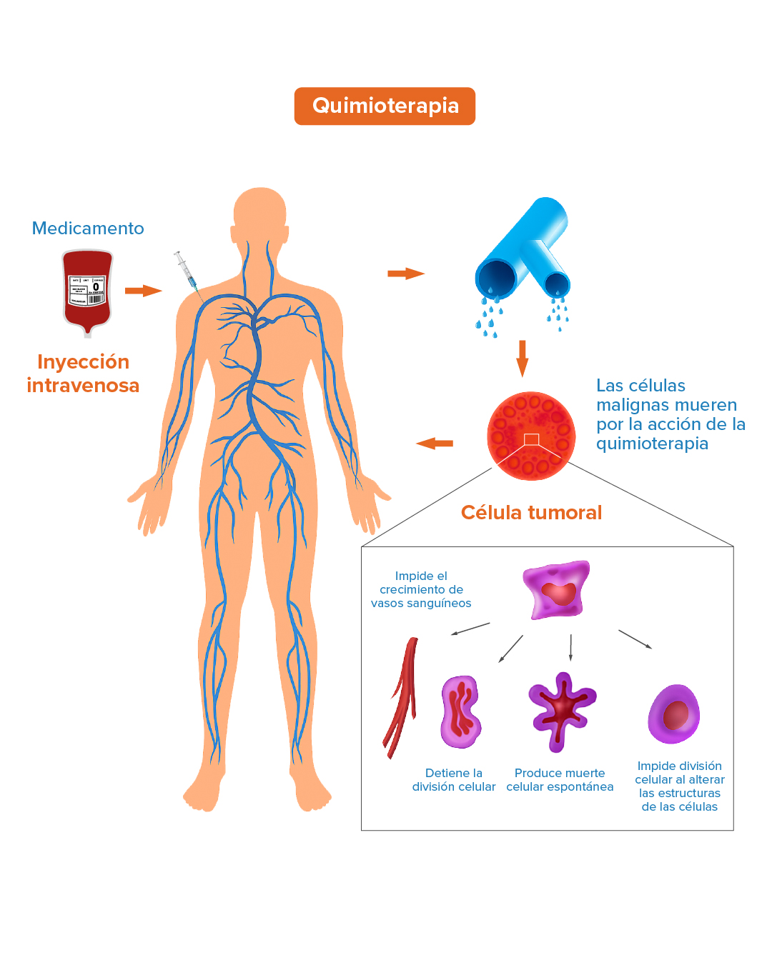 Quimioterapia 1